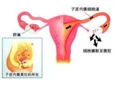 关于子宫内膜厚度多少才算正常，你了解多少呢？