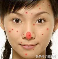 关于痘痘肌肤应该如何护肤,关于痘痘治疗方法