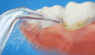 牙齿黄美白小妙招,牙齿黄怎么笑好看