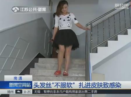 头发被传染奇痒难耐怎么办啊,头发丝不光滑是什么原因