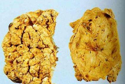 宝宝的胎盘可以吃吗有没有啥说法,胎盘可以吃吗小孩子