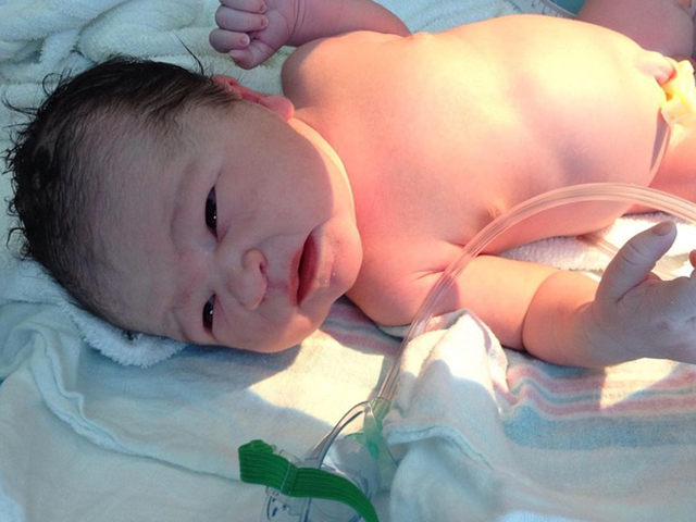 胎儿在肚子里为什么会吸入胎粪,胎儿在肚子里会不会拉屎尿尿