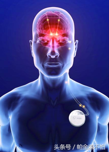 名医治疗帕金森,医生建议帕金森病早诊早治