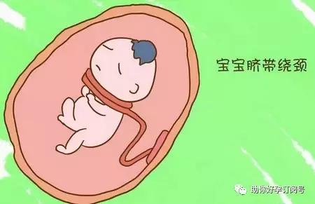 23周的胎儿脐带绕颈三周有影响么,孕37周脐带绕颈三周爬床能绕开吗