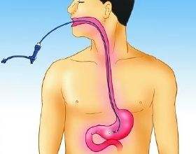 做胃镜很痛苦,有什么办法可以让做胃镜不再受罪?这两个办法好!