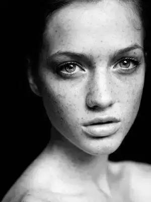 色斑暗沉没有光泽,遮不掉的黑眼圈祛不掉的痘印