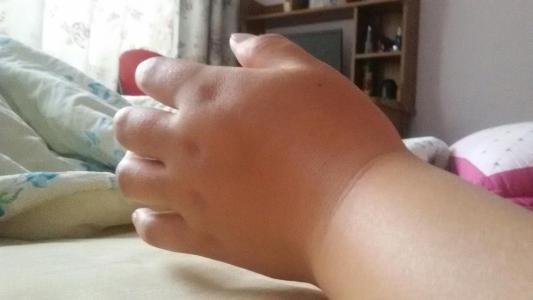 怀孕肿手肿脚怎么回事,怀孕三个月腿脚肿正常吗