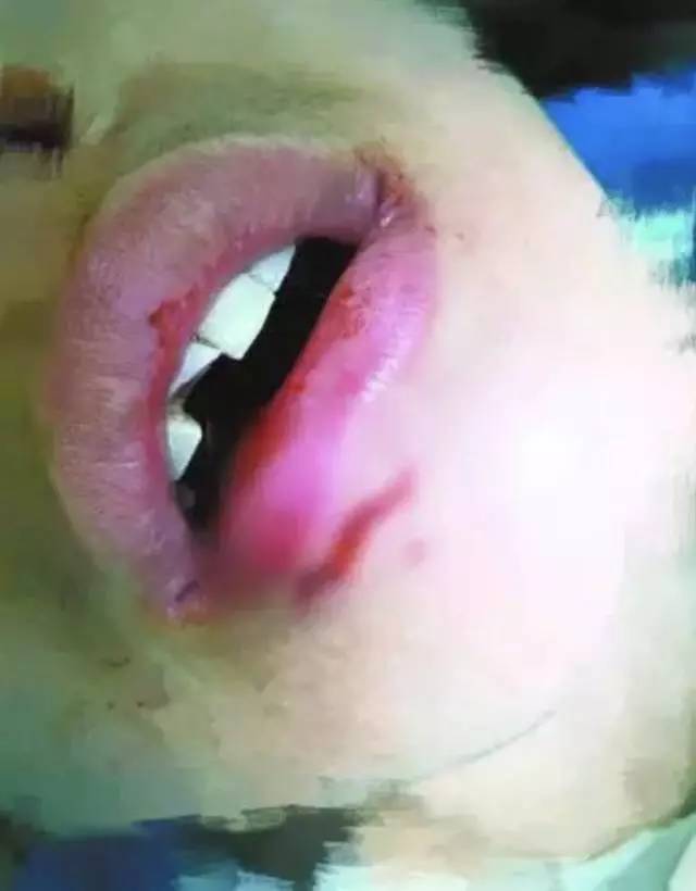 宜家玻璃杯自爆为什么,宜家水杯突然炸裂