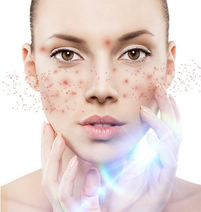 激光美肤好不好,激光美肤全过程