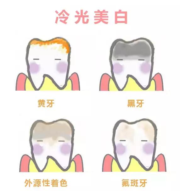 拥有一个好牙,拥有一口好的牙齿很重要