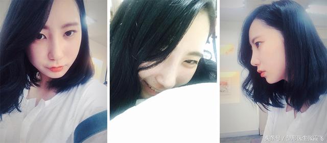 杭州美莱鼻综合最好的医生,杭州格莱美鼻尖整形怎样