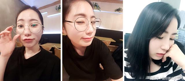 杭州美莱鼻综合最好的医生,杭州格莱美鼻尖整形怎样