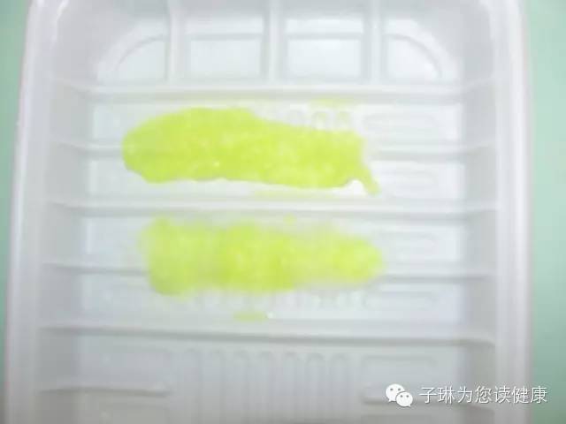 喝酒后嘴唇起皮裂口是怎么回事,嘴唇裂口起皮是什么原因