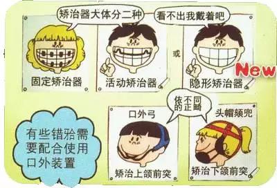 儿童早期牙齿矫正的流程,牙齿矫正的步骤和流程