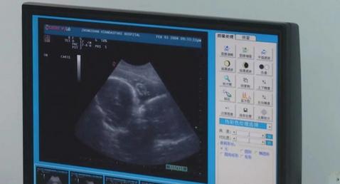 女子医院产检，当得知结果后竟做出了一个让医生震惊的决定