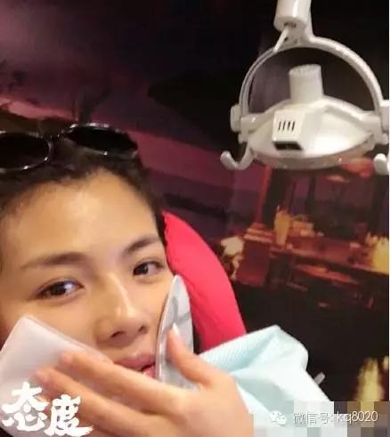 刘涛明星换牙是真是假,刘涛是全种植牙还是换牙