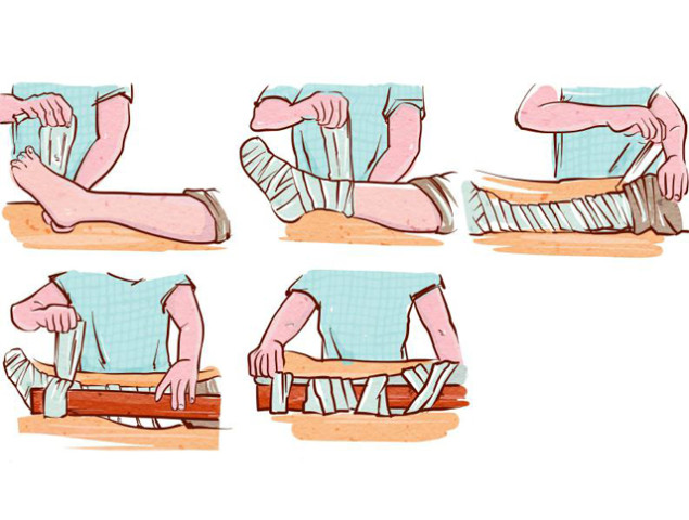 儿童意外急救小知识,儿童急救常识100个小知识