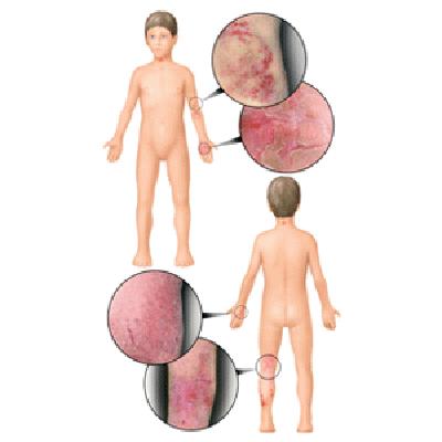 实用皮肤病验方精选,所有治疗皮肤病的药理良方