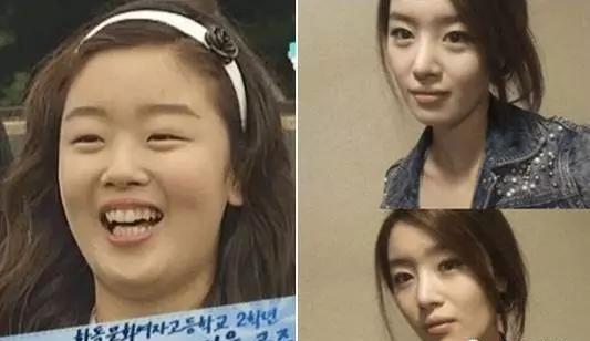 鼻子垫的太往上了,鼻子垫得不高是不是不容易歪