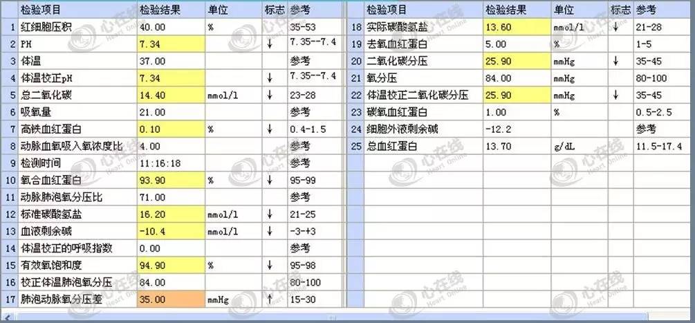 急性心肌梗死心源性休克时的处理,急性心肌梗死心源性休克最常见
