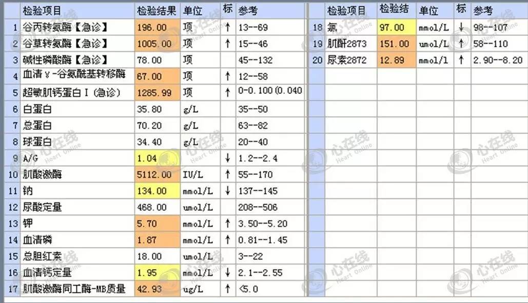 急性心肌梗死心源性休克时的处理,急性心肌梗死心源性休克最常见