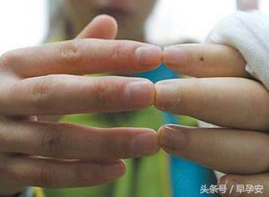 孕期脚肿怎么消肿最好最快,孕期水肿腿如何消肿图片