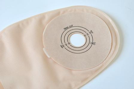 什么是人造肛门？为什么有的能还纳有的要带终身