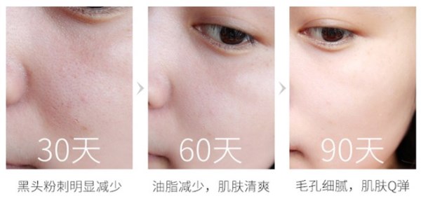 娜丽丝毛孔调理水,娜丽丝毛孔收敛水痘痘肌能用嘛