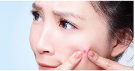 痘痘反复不停如何正确祛痘,痘痘反复长睡前这样做祛痘不再难