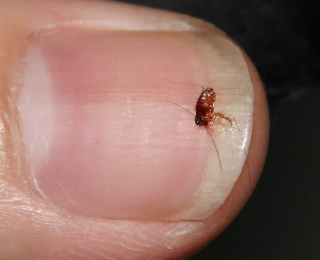 关于跳蚤叮咬人的三个小故事，也许你也经历过！