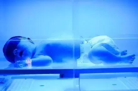 当宝宝遇上母乳性黄疸,桐妈育儿宝宝感冒发烧