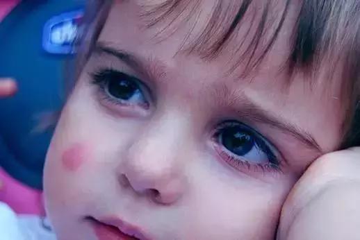 为什么蚊子只咬你很少咬别人,为什么蚊子只咬你不咬别人