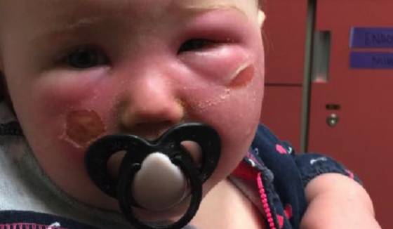 防晒喷雾被曝光,澳洲儿童防晒喷雾