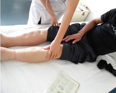 肾病彻底治愈,慢性肾炎能不治自愈