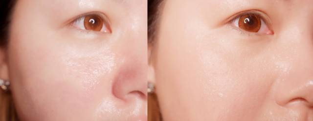 喷雾补水神器携带方便,喷雾补水神器大点