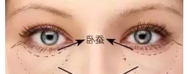 眼袋和卧蚕的区别看完你就知,卧蚕眼袋还在傻傻分不清楚