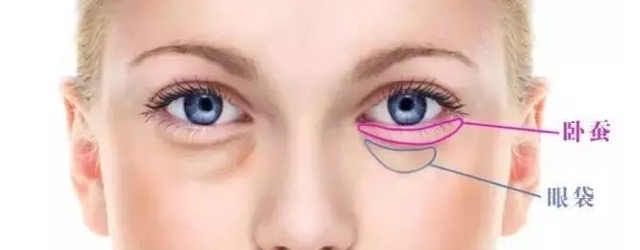 眼袋和卧蚕的区别看完你就知,卧蚕眼袋还在傻傻分不清楚