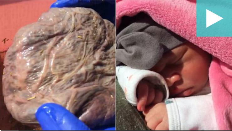 莲花分娩的好处,自然分娩的十种方法