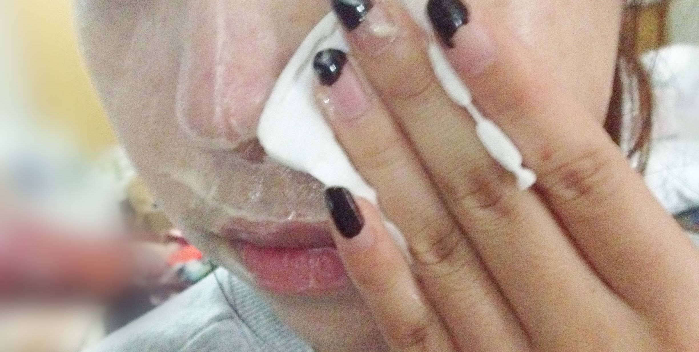 下巴长针眼大小白脓点是怎么回事,下巴有毛毛刺是什么原因