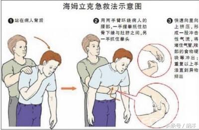 发生气道异物首选急救方法,气道异物抢救措施