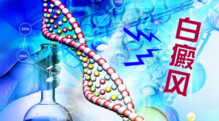 一年的白癜风能不能完全治愈,年轻人如何快速治愈白癜风