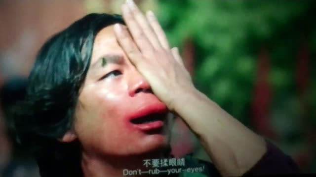 化妆品对白癜风有什么影响,白癜风用哪种化妆品比较好