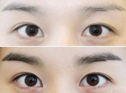 没有眉毛怎么办吃什么长出来,没有眉毛怎么办文案