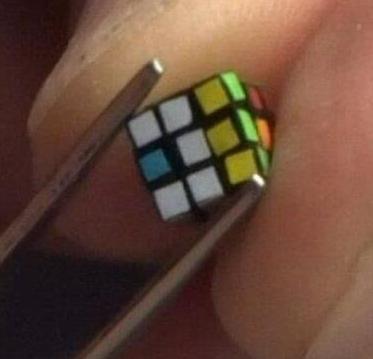 盘点最奇葩的吉尼斯纪录,世界上肾脏最多的人破吉尼斯纪录