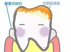 拥有一个好牙,拥有一口好的牙齿很重要