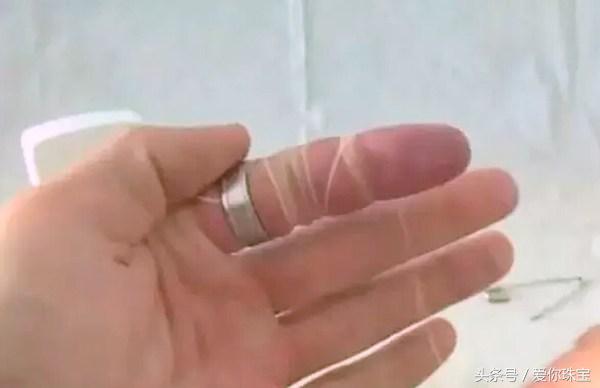手胖了戒指取不下来,长胖后戒指摘不下来怎么办