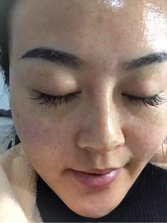 十岁女孩脸上长斑怎么才能淡化,吃什么能淡化脸上的斑和黑色素