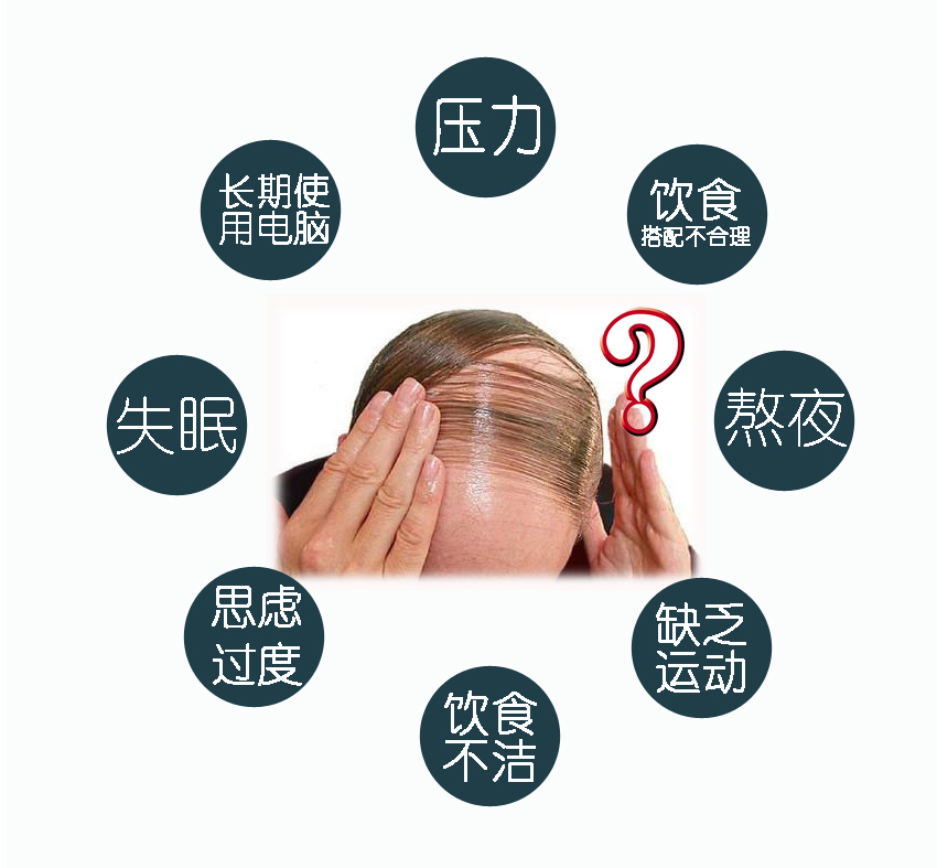 脱发最好的治疗方法用什么,各类型脱发的科学防治