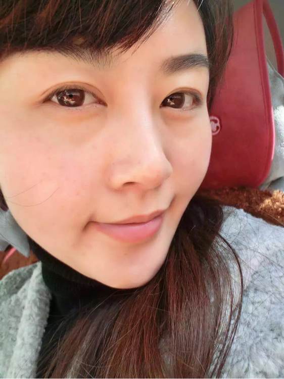 十岁女孩脸上长斑怎么才能淡化,吃什么能淡化脸上的斑和黑色素