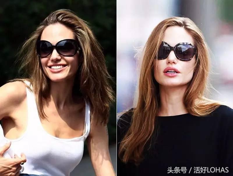 整容的正确方法和技巧,整容最省钱的十种方法